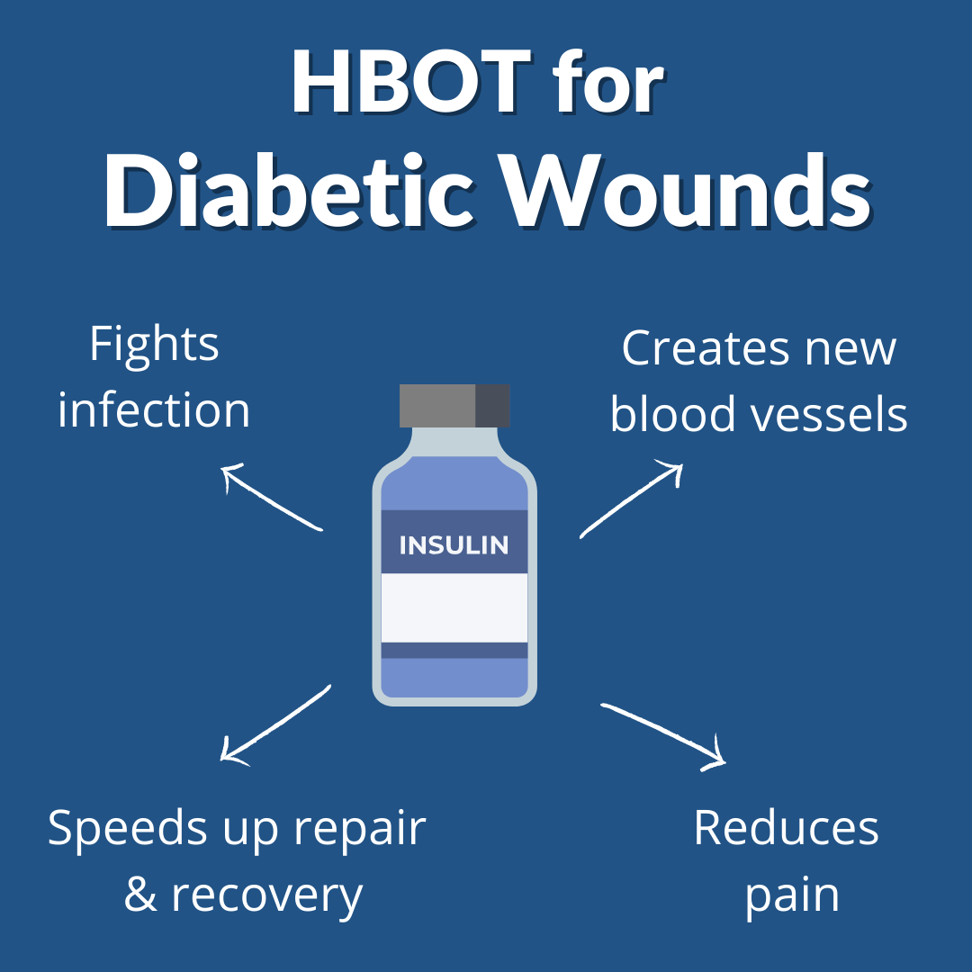 Hyperbaric Oxygen Therapy as a Diabetic Foot Ulcer Treatment